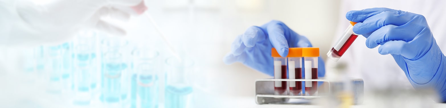 Private Blood Tests London Banner